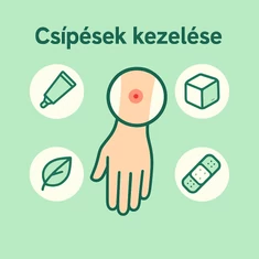 Csípések megelőzése és kezelése